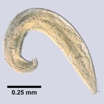 Image of Enterobius vermicularis